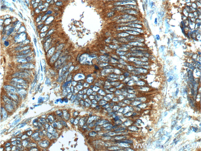 S100A16 Antibody in Immunohistochemistry (Paraffin) (IHC (P))