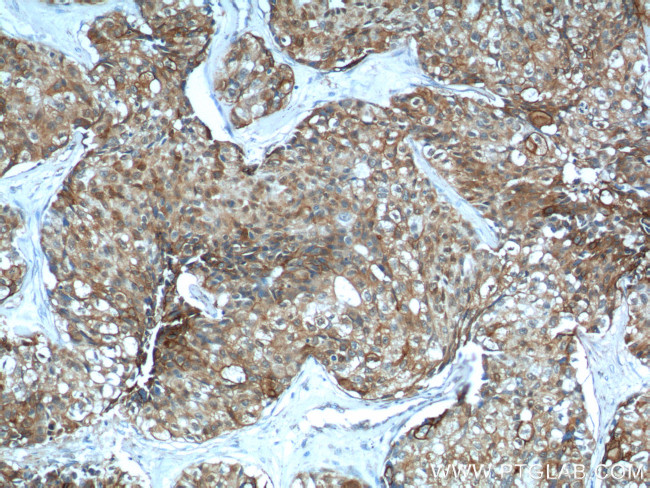 S100A16 Antibody in Immunohistochemistry (Paraffin) (IHC (P))