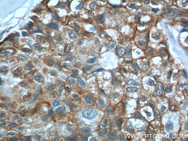 S100A16 Antibody in Immunohistochemistry (Paraffin) (IHC (P))