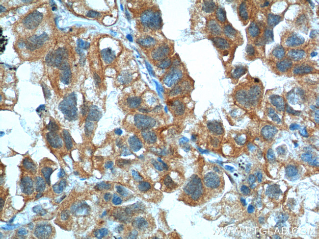 S100A16 Antibody in Immunohistochemistry (Paraffin) (IHC (P))