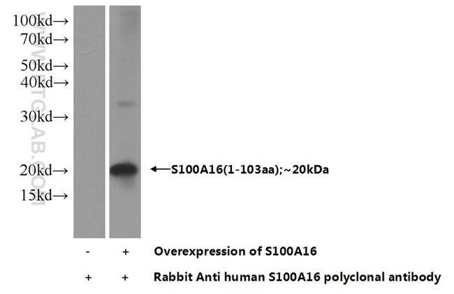 S100A16 Antibody in Western Blot (WB)