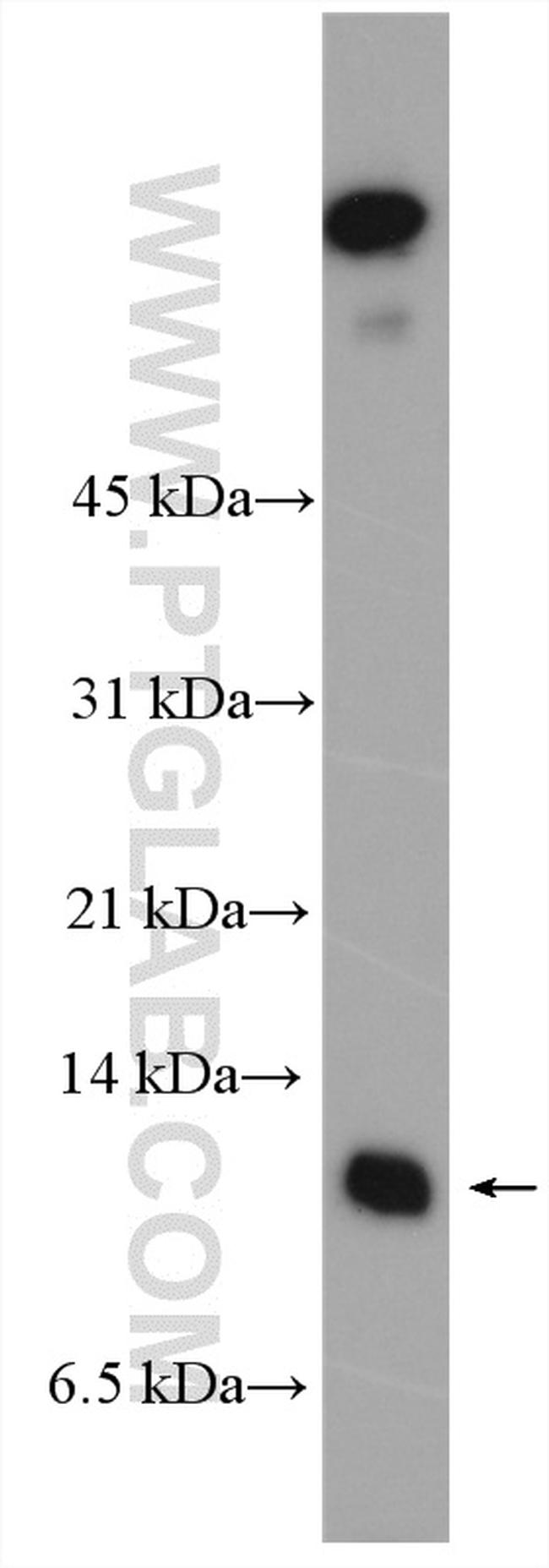 S100A16 Antibody in Western Blot (WB)