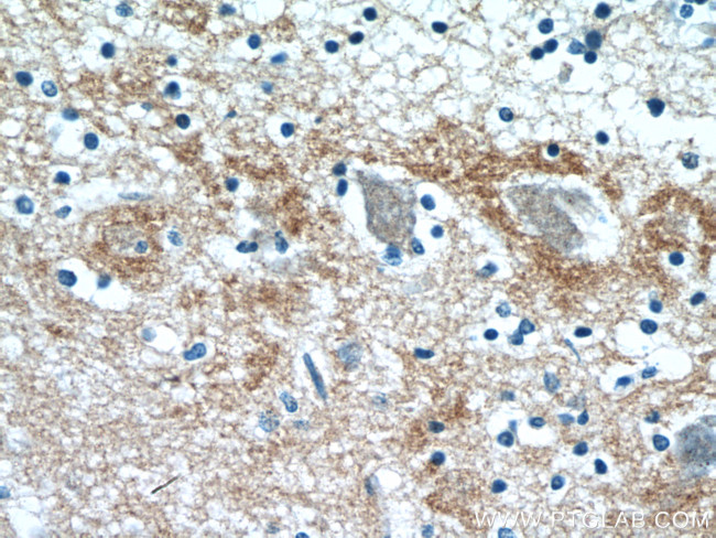 STXBP1 Antibody in Immunohistochemistry (Paraffin) (IHC (P))