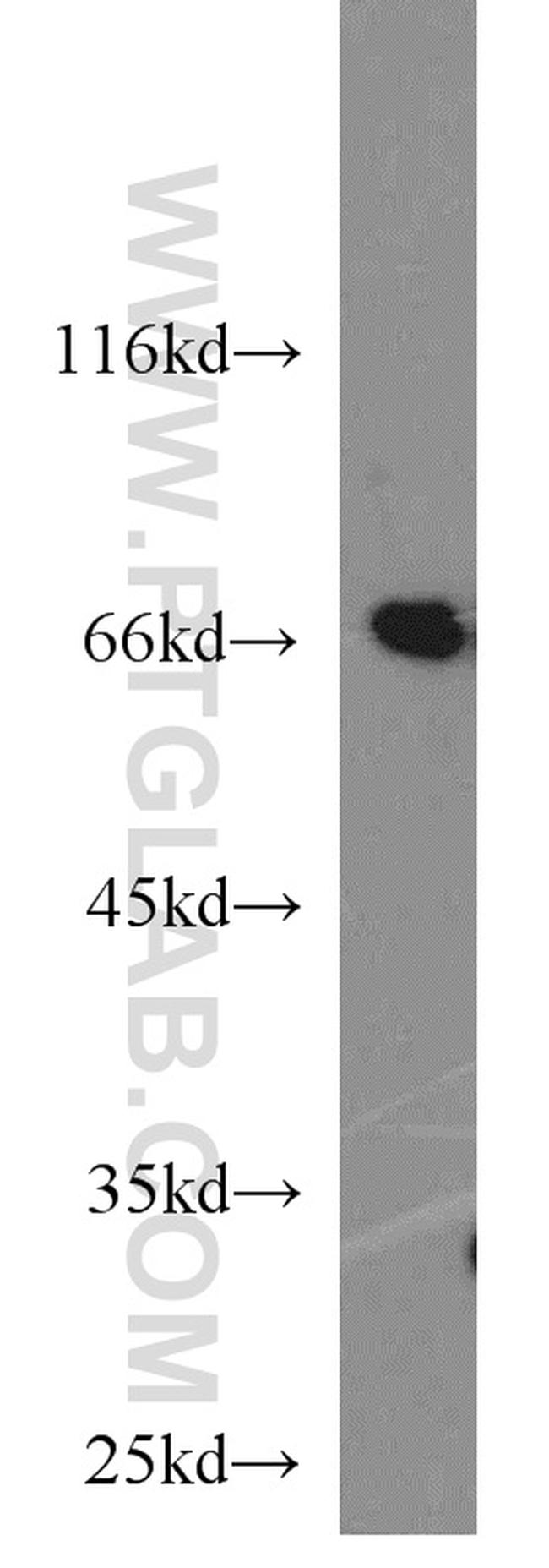 STXBP1 Antibody in Western Blot (WB)