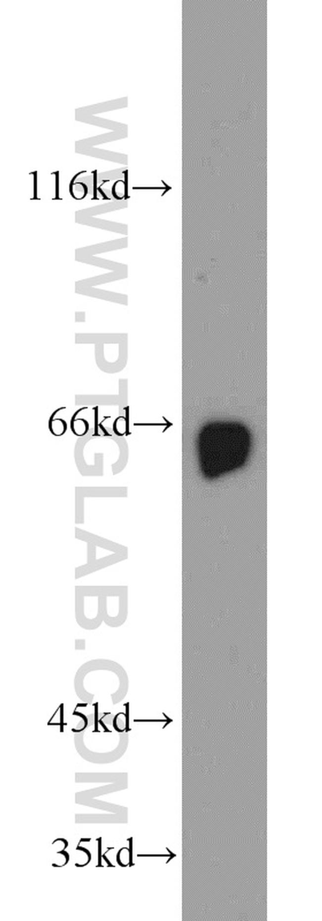 STXBP1 Antibody in Western Blot (WB)