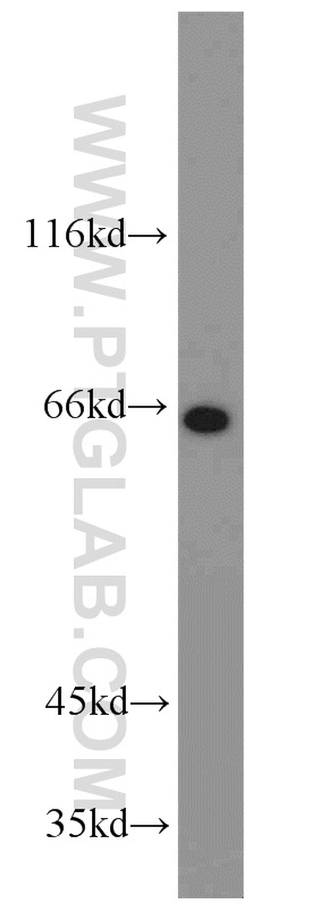 STXBP1 Antibody in Western Blot (WB)