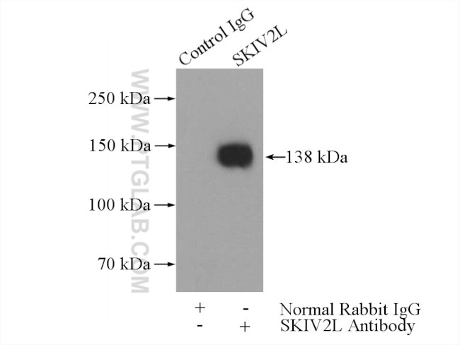 SKIV2L Antibody in Immunoprecipitation (IP)