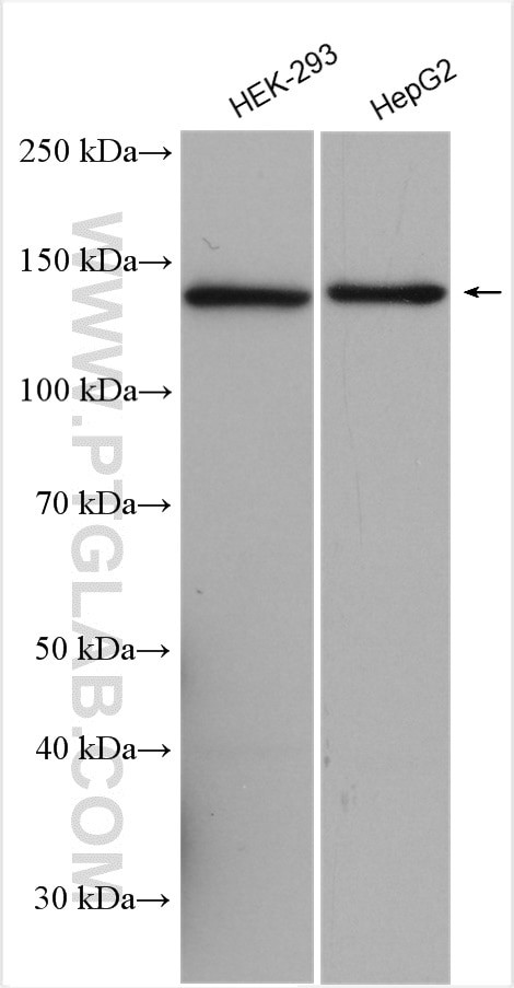 SKIV2L Antibody in Western Blot (WB)