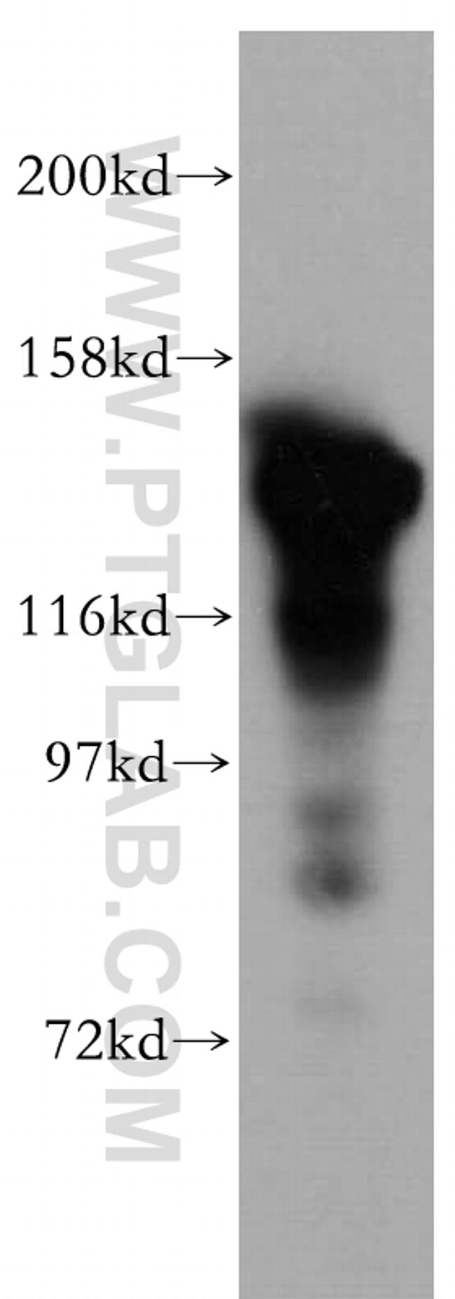 SKIV2L Antibody in Western Blot (WB)