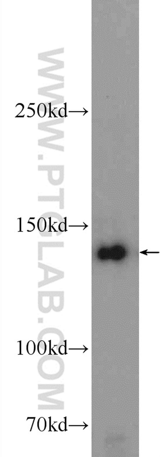 SKIV2L Antibody in Western Blot (WB)