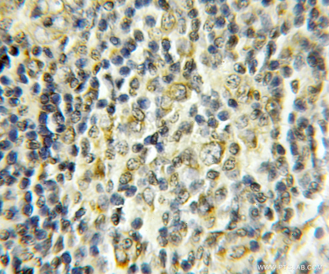 COX17 Antibody in Immunohistochemistry (Paraffin) (IHC (P))