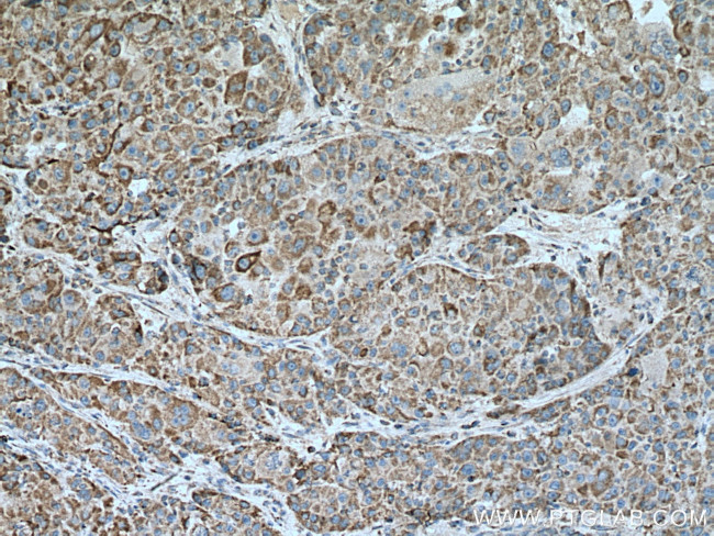 COX17 Antibody in Immunohistochemistry (Paraffin) (IHC (P))