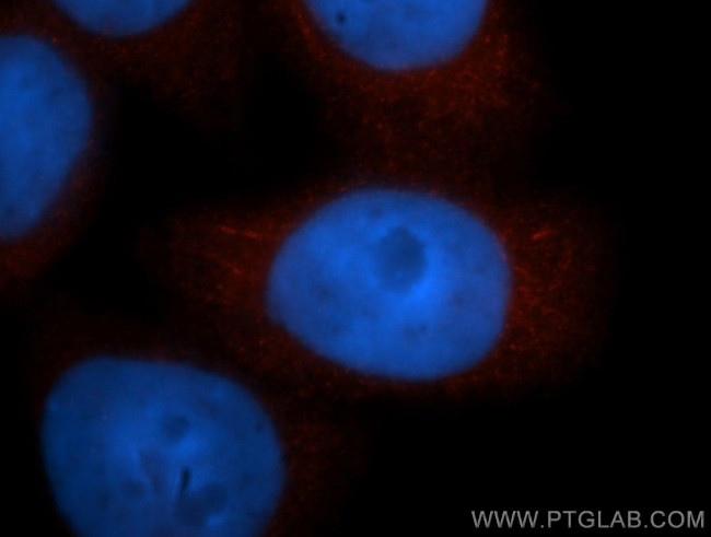 ADRM1 Antibody in Immunocytochemistry (ICC/IF)