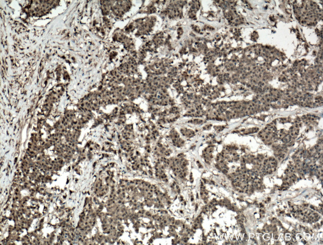 ADRM1 Antibody in Immunohistochemistry (Paraffin) (IHC (P))