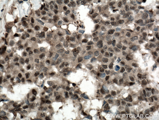 ADRM1 Antibody in Immunohistochemistry (Paraffin) (IHC (P))