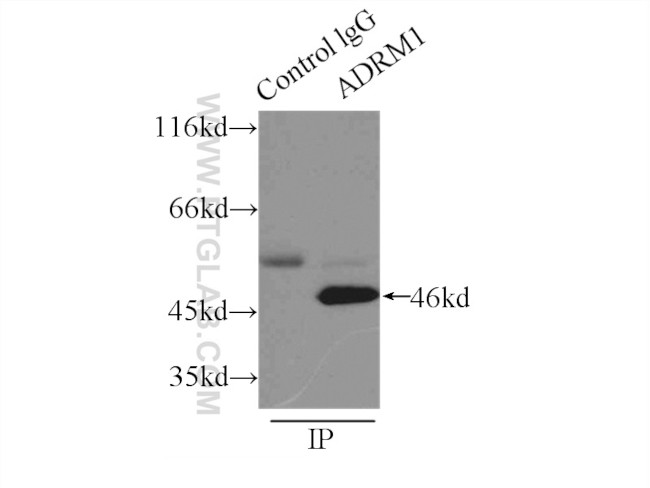 ADRM1 Antibody in Immunoprecipitation (IP)