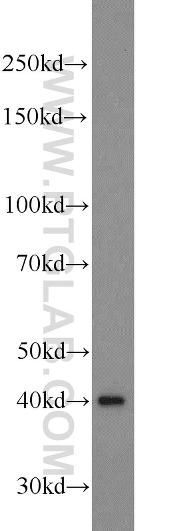 ADRM1 Antibody in Western Blot (WB)