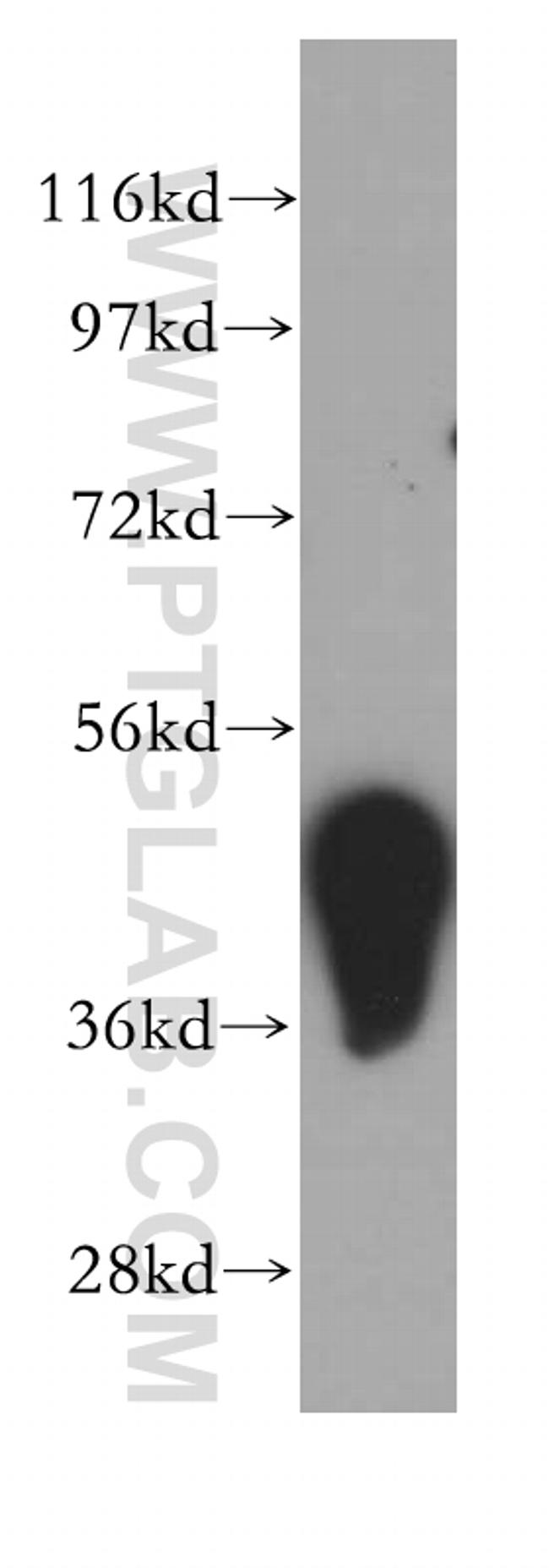 ADRM1 Antibody in Western Blot (WB)