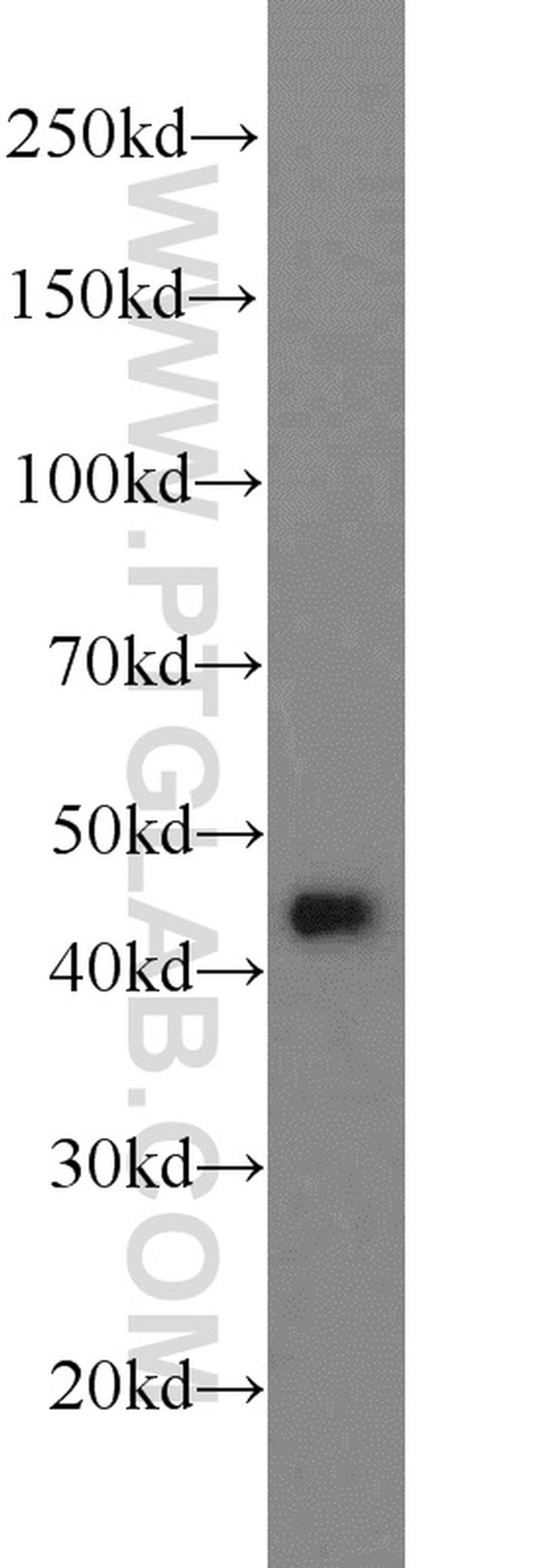 ADRM1 Antibody in Western Blot (WB)