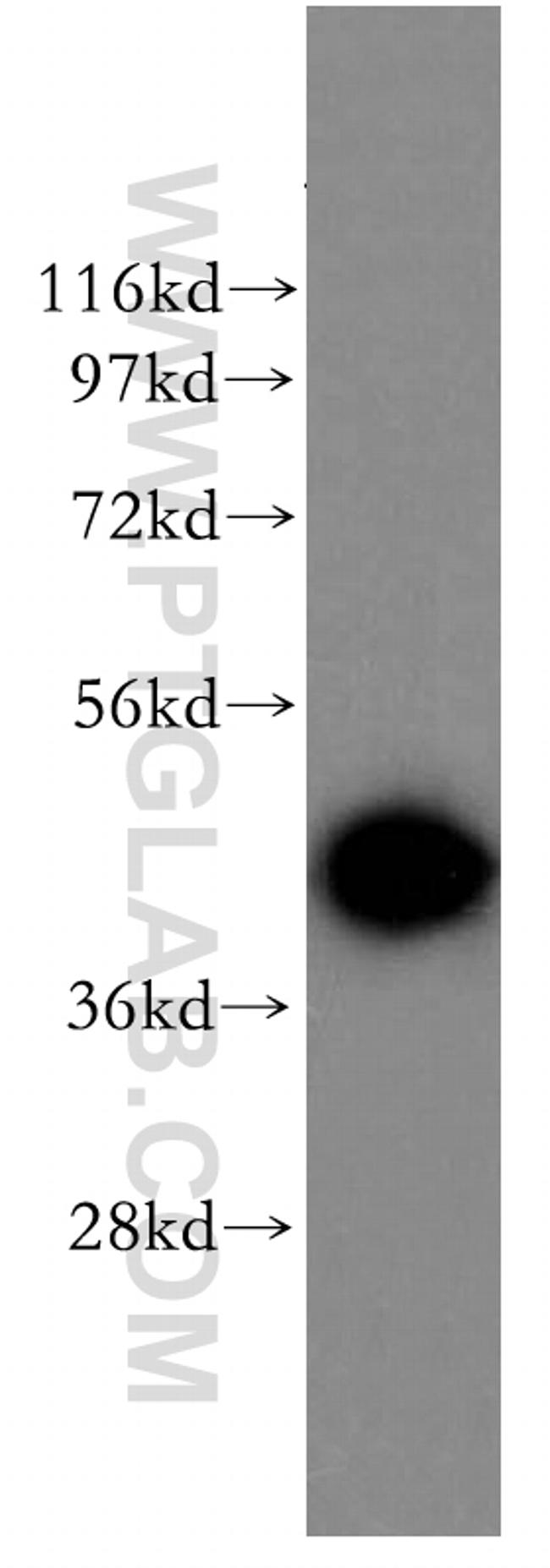 ADRM1 Antibody in Western Blot (WB)