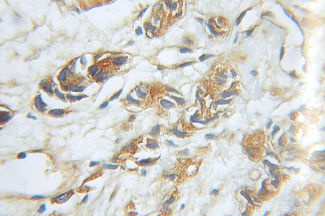 PSMD5 Antibody in Immunohistochemistry (Paraffin) (IHC (P))