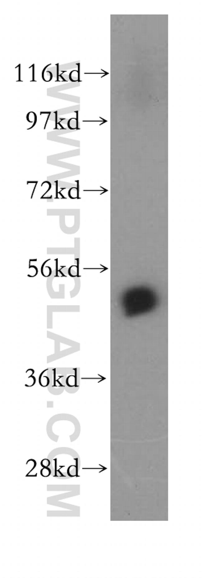 PSMD5 Antibody in Western Blot (WB)