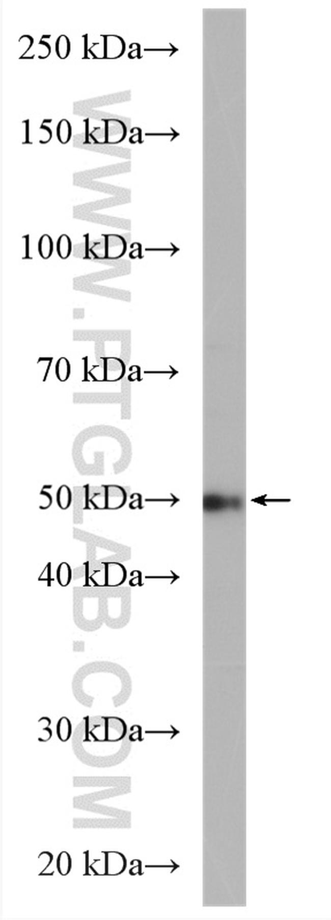 PSMD5 Antibody in Western Blot (WB)