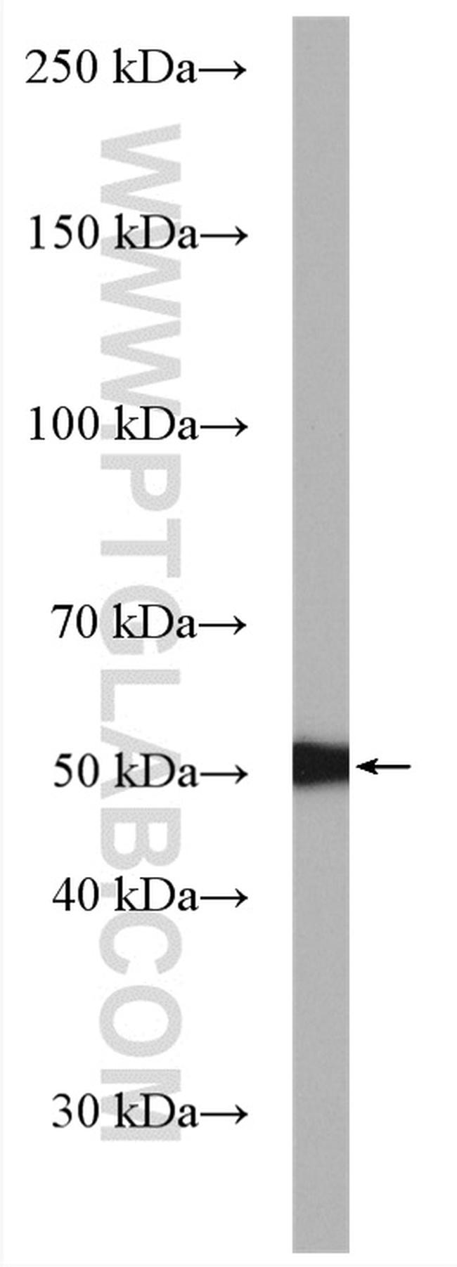 PSMD5 Antibody in Western Blot (WB)