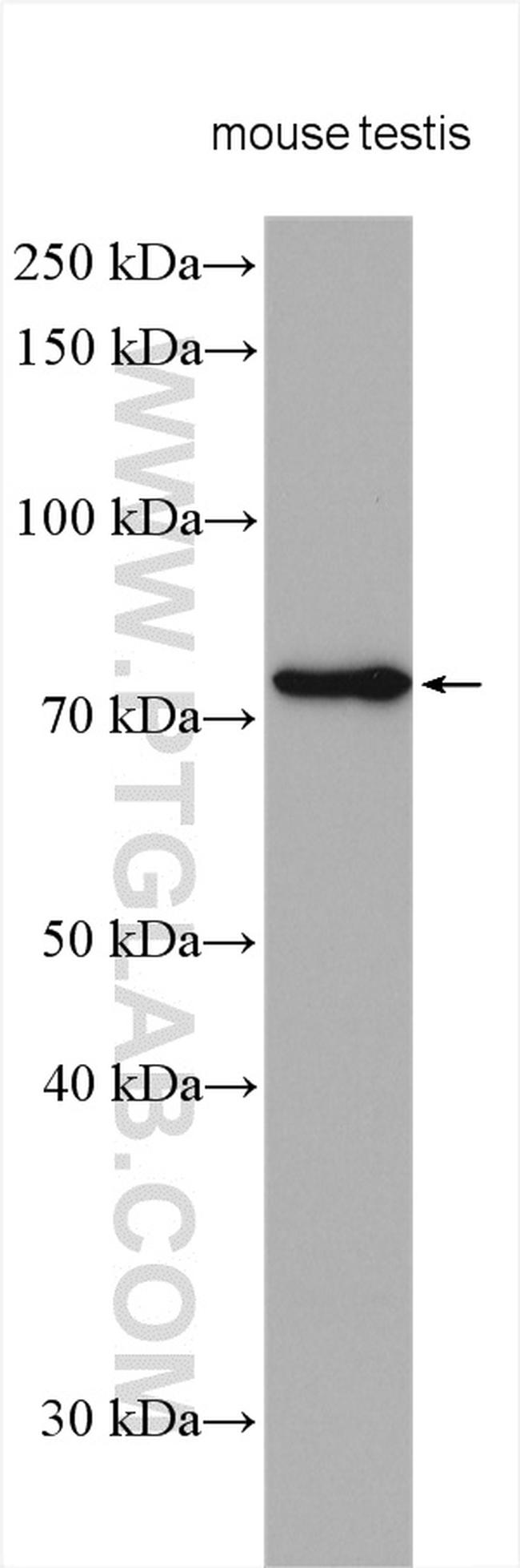 EFHC1 Antibody in Western Blot (WB)