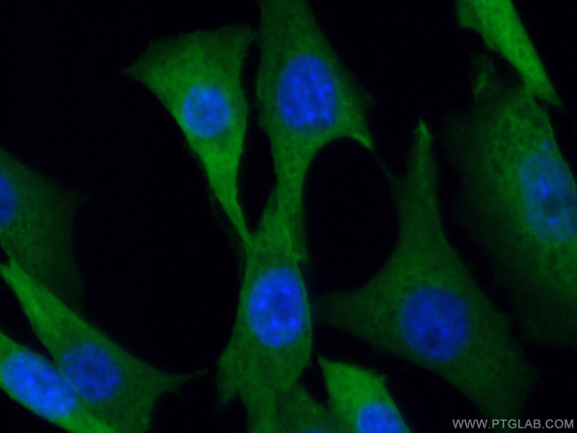 MTAP Antibody in Immunocytochemistry (ICC/IF)