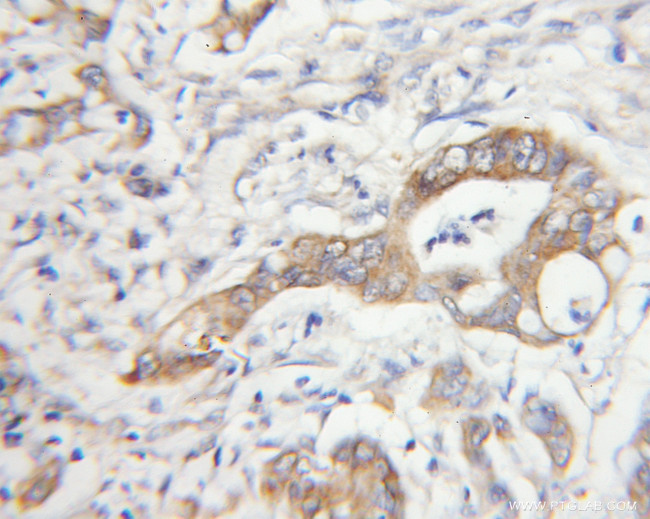 MTAP Antibody in Immunohistochemistry (Paraffin) (IHC (P))