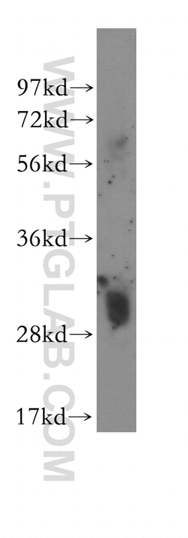 MTAP Antibody in Western Blot (WB)