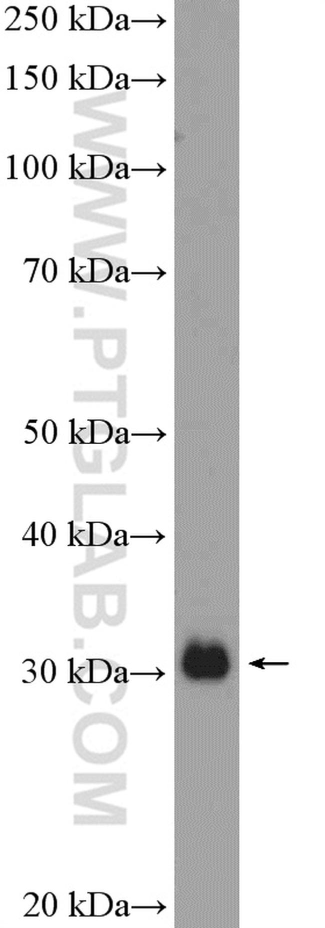 MTAP Antibody in Western Blot (WB)