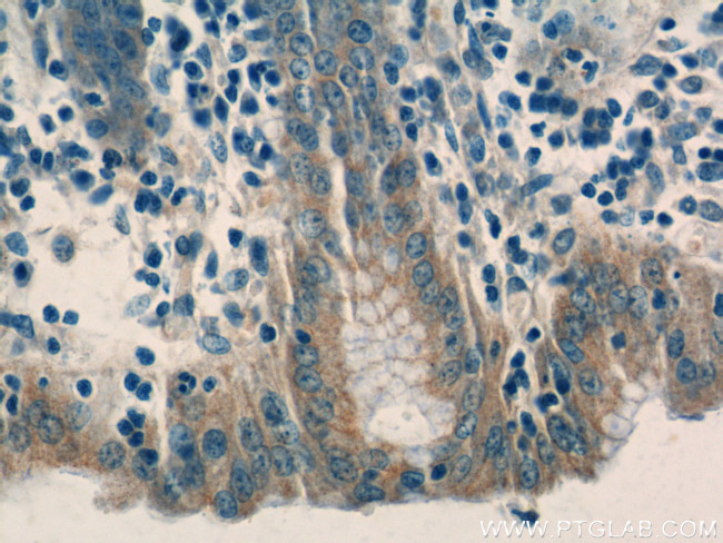 TRIM5 Antibody in Immunohistochemistry (Paraffin) (IHC (P))