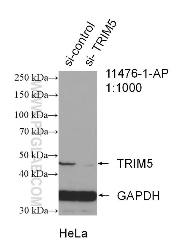 TRIM5 Antibody in Western Blot (WB)