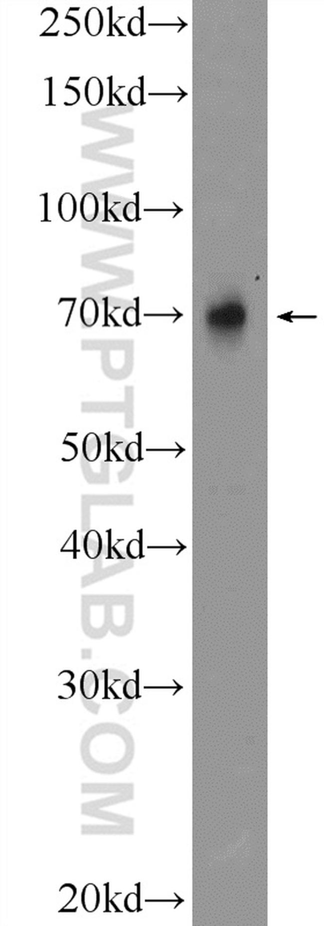 TRIM5 Antibody in Western Blot (WB)