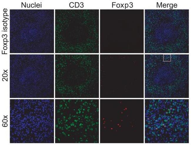 FOXP3 Antibody in Immunohistochemistry (Paraffin) (IHC (P))