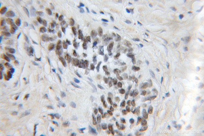 MPG Antibody in Immunohistochemistry (Paraffin) (IHC (P))