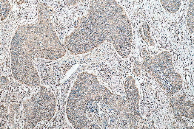 AGS3 Antibody in Immunohistochemistry (Paraffin) (IHC (P))