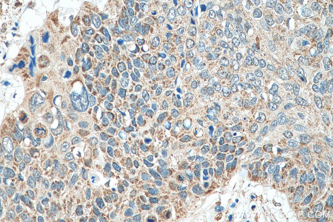 AGS3 Antibody in Immunohistochemistry (Paraffin) (IHC (P))