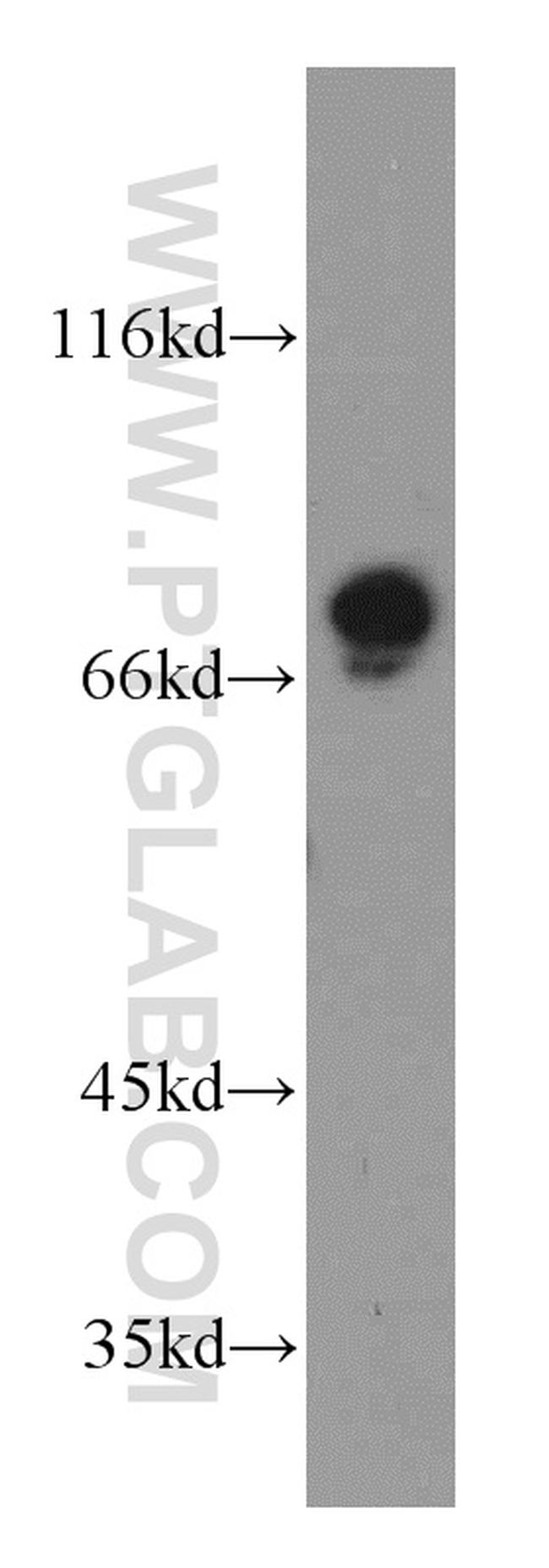 AGS3 Antibody in Western Blot (WB)