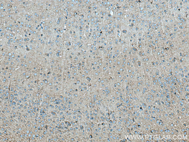 SCN1B Antibody in Immunohistochemistry (Paraffin) (IHC (P))