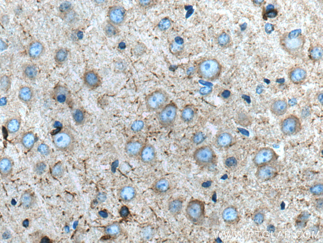 SCN1B Antibody in Immunohistochemistry (Paraffin) (IHC (P))