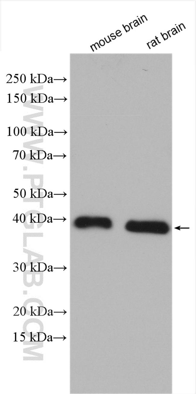 SCN1B Antibody in Western Blot (WB)