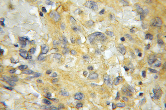 SCRN2 Antibody in Immunohistochemistry (Paraffin) (IHC (P))