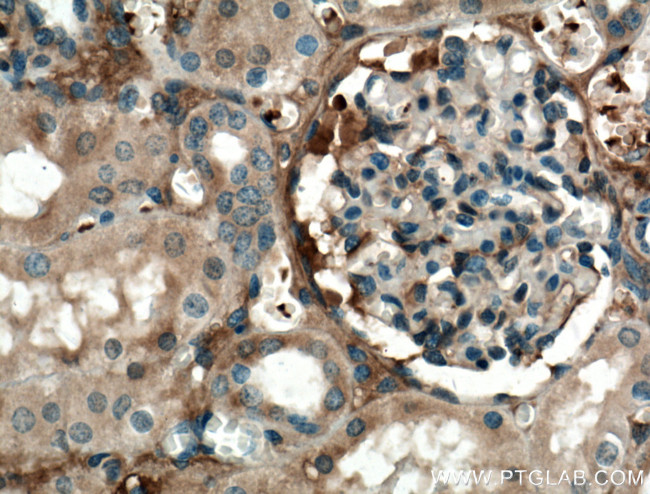 APOL1 Antibody in Immunohistochemistry (Paraffin) (IHC (P))