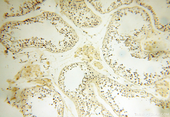 APOL1 Antibody in Immunohistochemistry (Paraffin) (IHC (P))