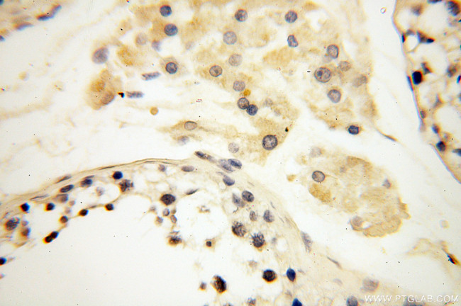 APOL1 Antibody in Immunohistochemistry (Paraffin) (IHC (P))