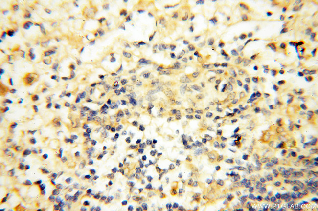 APOL1 Antibody in Immunohistochemistry (Paraffin) (IHC (P))