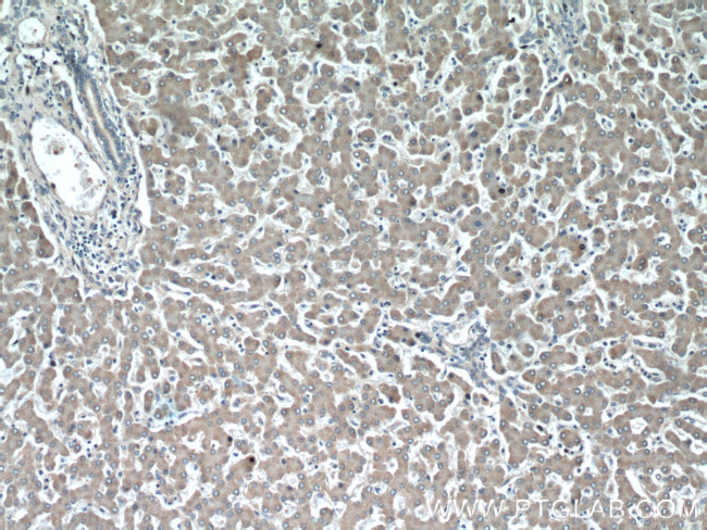 APOL1 Antibody in Immunohistochemistry (Paraffin) (IHC (P))